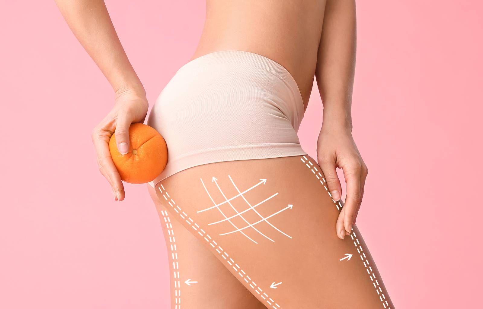 Traitement anti-cellulite Toulon Var 83